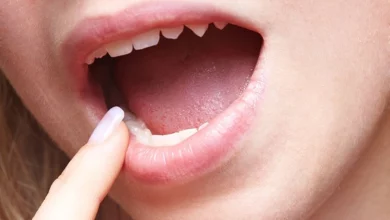 The Benefits of Keeping Wisdom Teeth