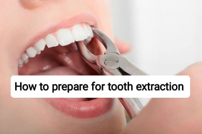 How to prepare for tooth extraction